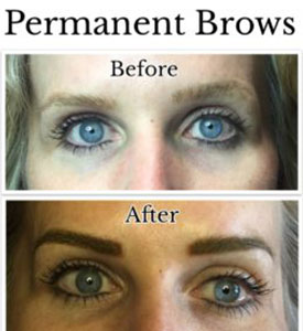 Permanent Eyeliner Before and After Photos